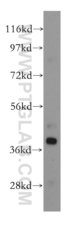 15297-1-AP;human liver tissue