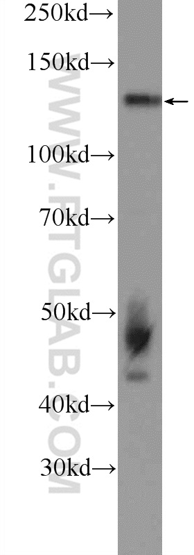 15706-1-AP;SGC-7901 cells