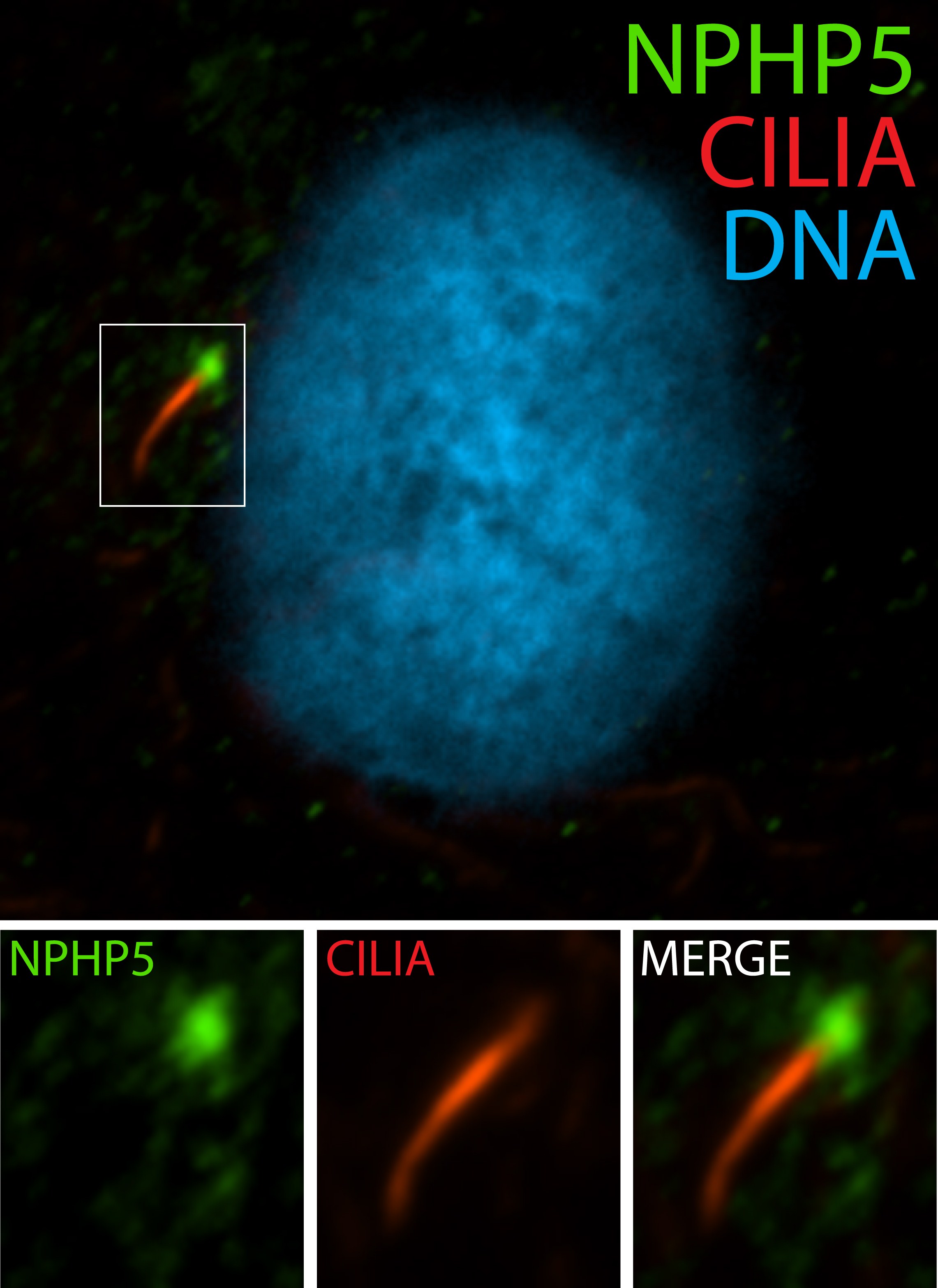 15747-1-AP;hTERT-RPE1 cells