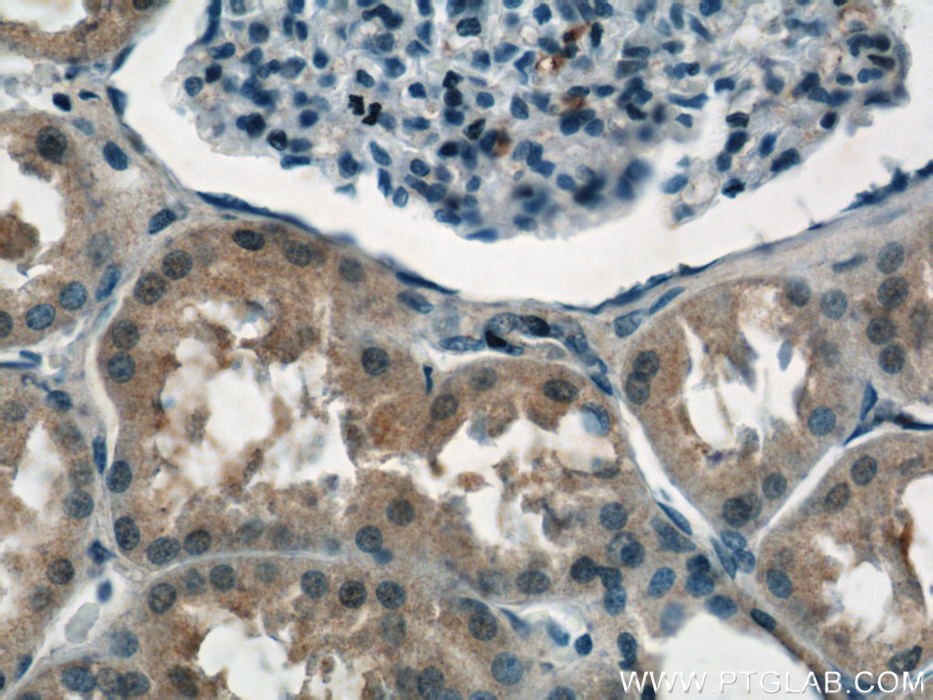 11638-1-AP;human kidney tissue