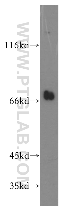 11638-1-AP;mouse kidney tissue