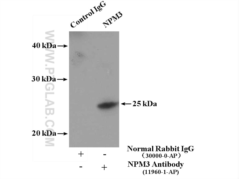 11960-1-AP;HeLa cells