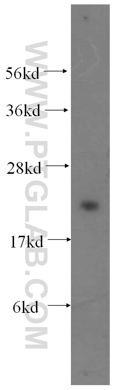 11960-1-AP;HeLa cell