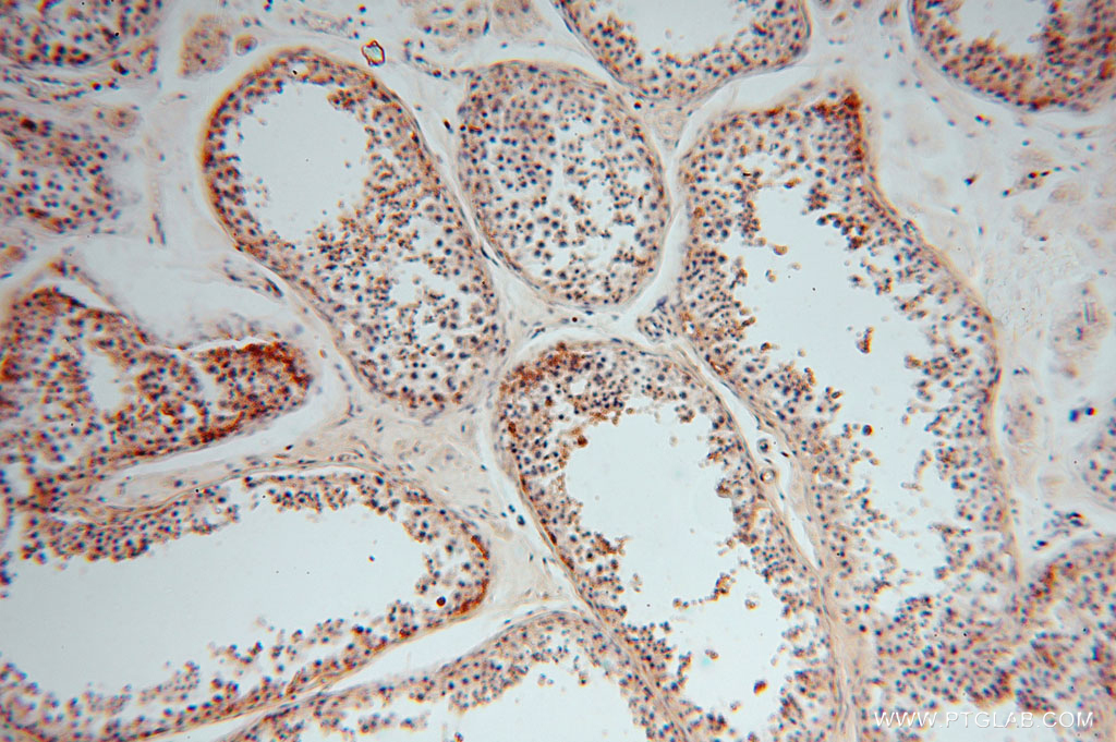 15630-1-AP;human testis