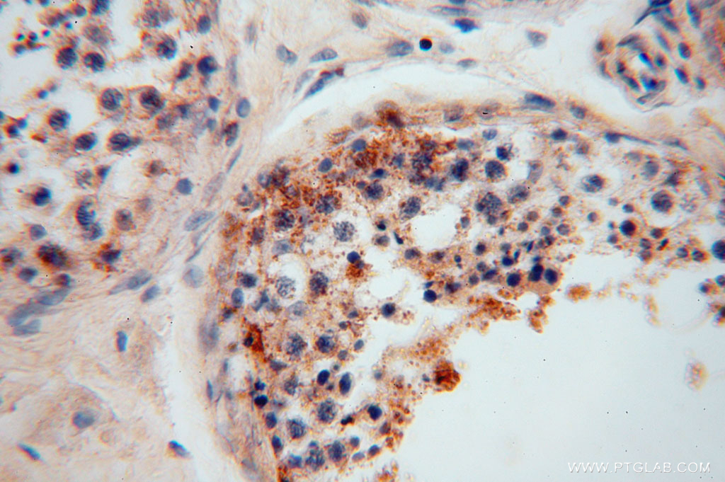 15630-1-AP;human testis