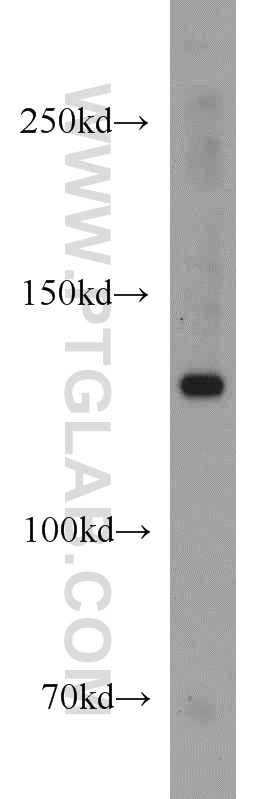 15630-1-AP;K-562 cells