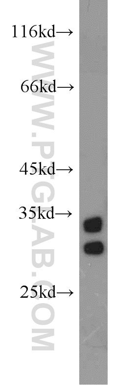 16292-1-AP;human testis tissue