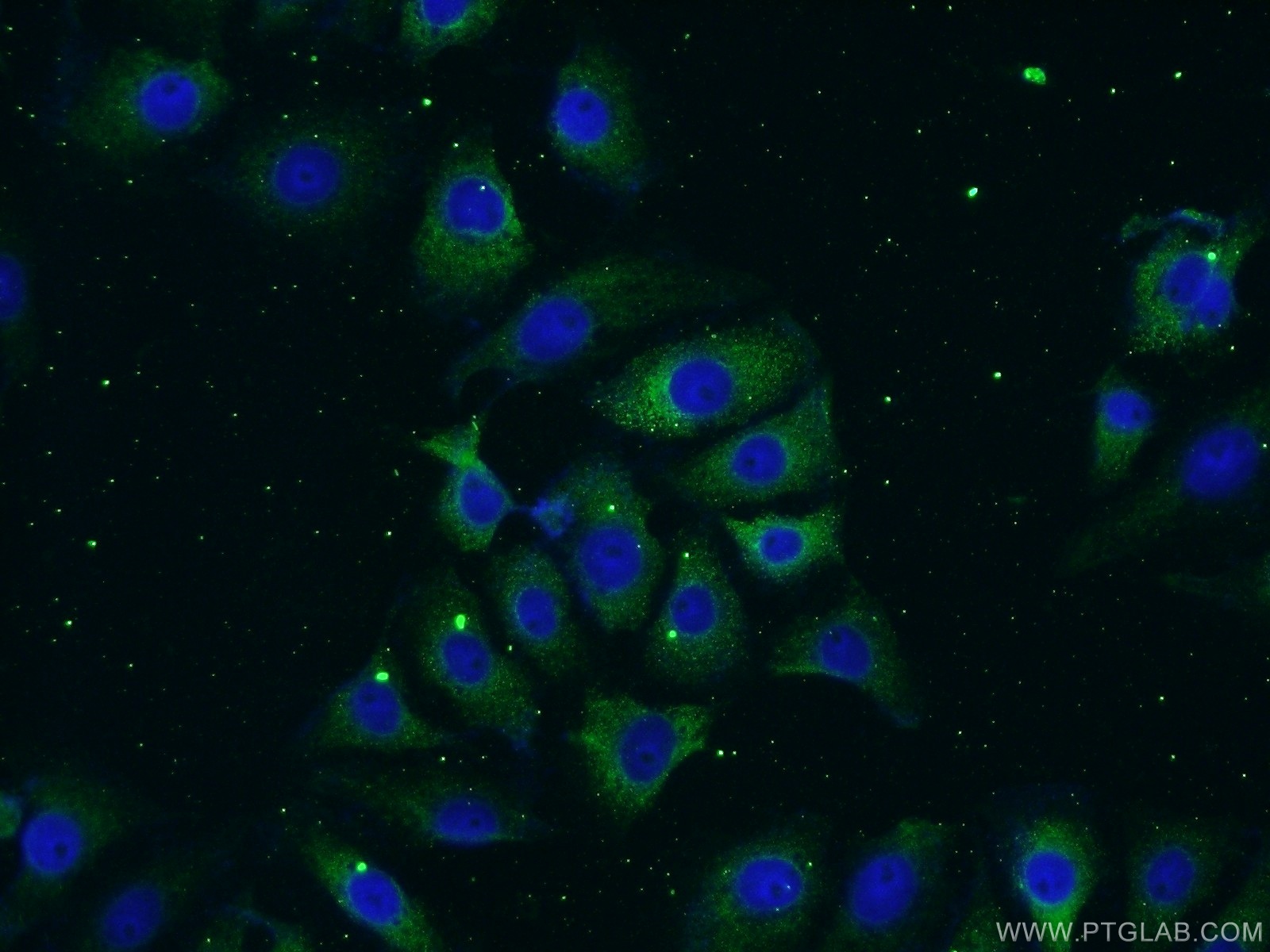 18084-1-AP;SH-SY5Y cells