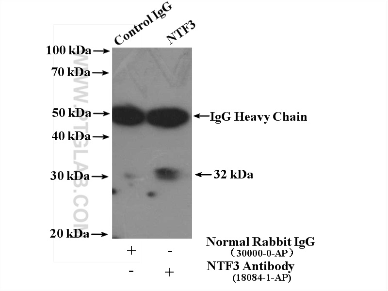 18084-1-AP;SH-SY5Y cells