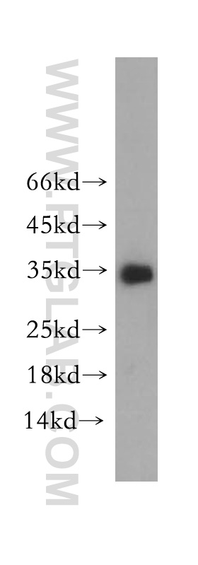 18084-1-AP;SH-SY5Y cell