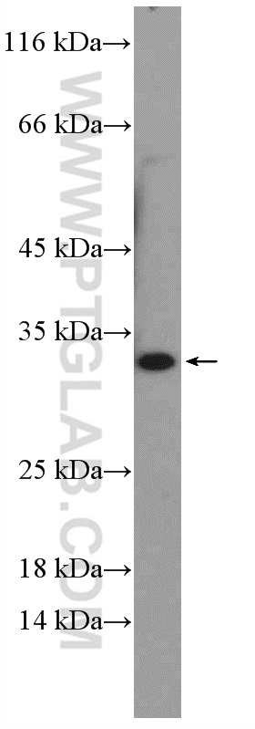 17393-1-AP;mouse colon tissue