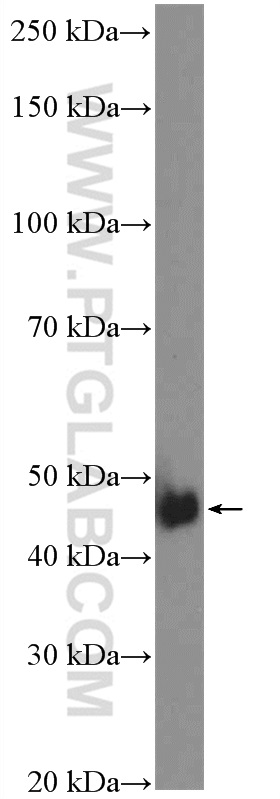 17487-1-AP;HeLa cells