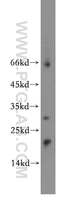 20542-1-AP;mouse cerebellum tissue