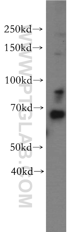 19907-1-AP;HepG2 cell