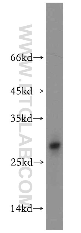 11203-1-AP;mouse brain tissue