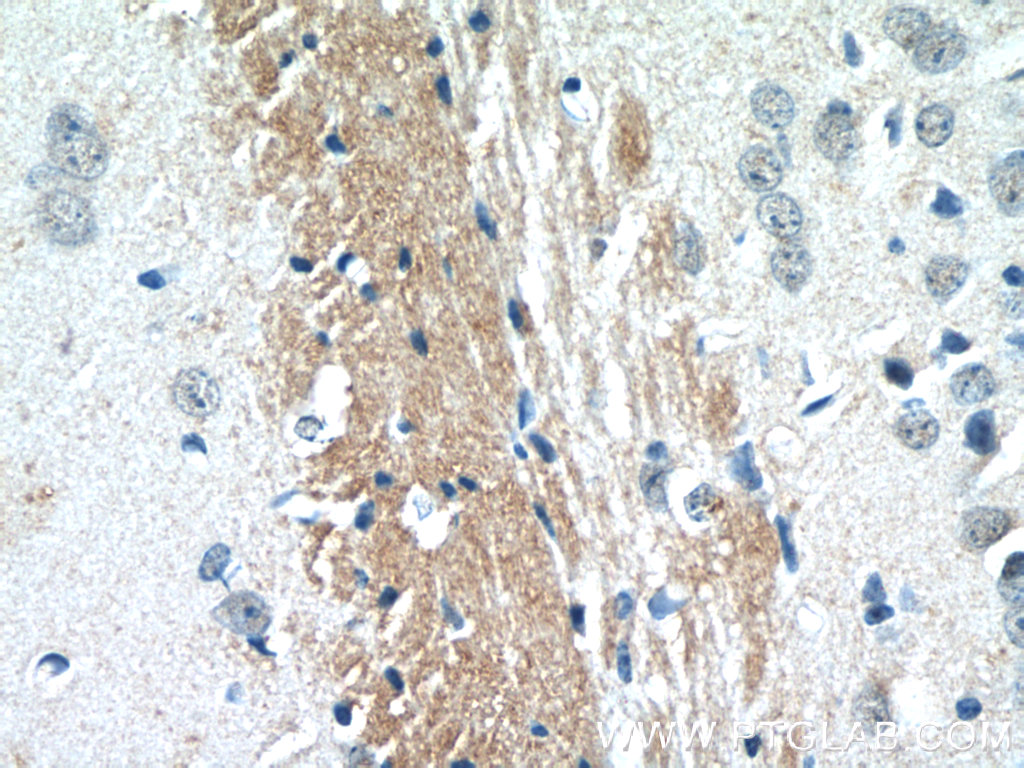 25108-1-AP;mouse brain tissue