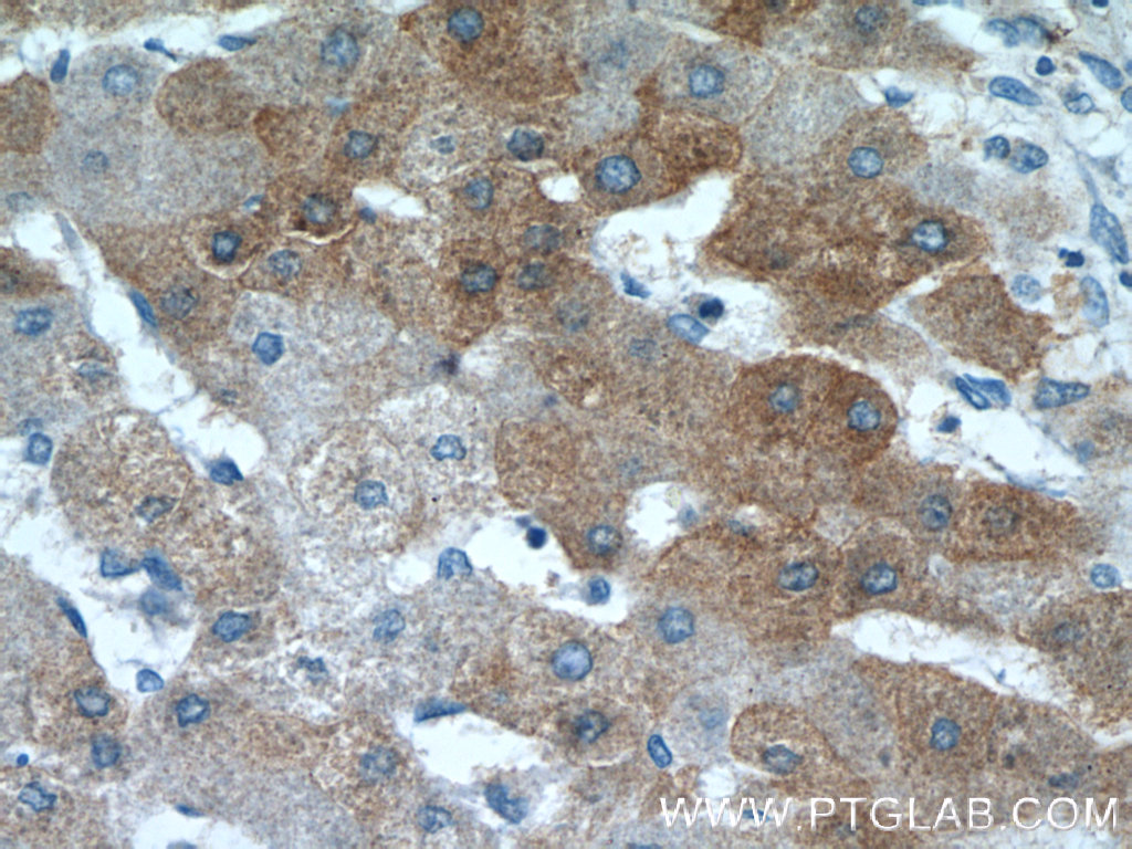 19842-1-AP;human hepatocirrhosis tissue