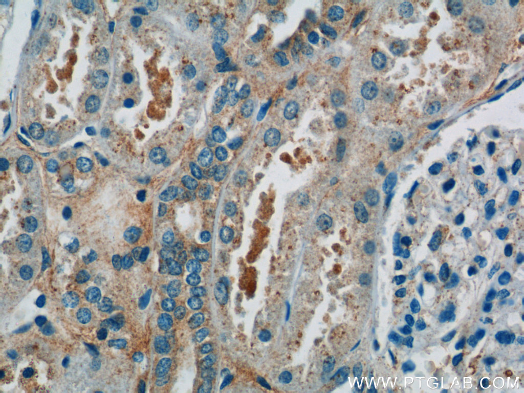 19842-1-AP;human kidney tissue