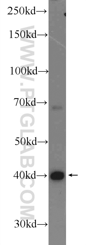 19842-1-AP;mouse liver tissue