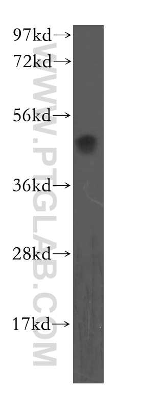 11837-1-AP;human liver tissue