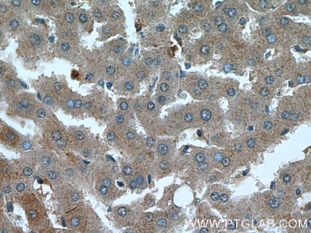 17116-1-AP;human liver tissue