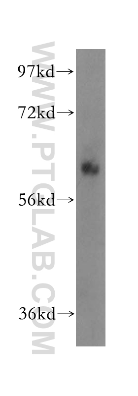 17116-1-AP;mouse liver tissue