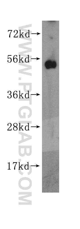 11542-1-AP;mouse ovary tissue