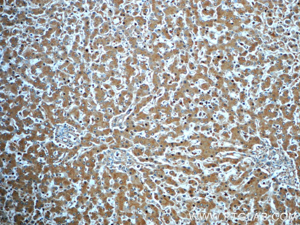 16439-1-AP;human liver tissue