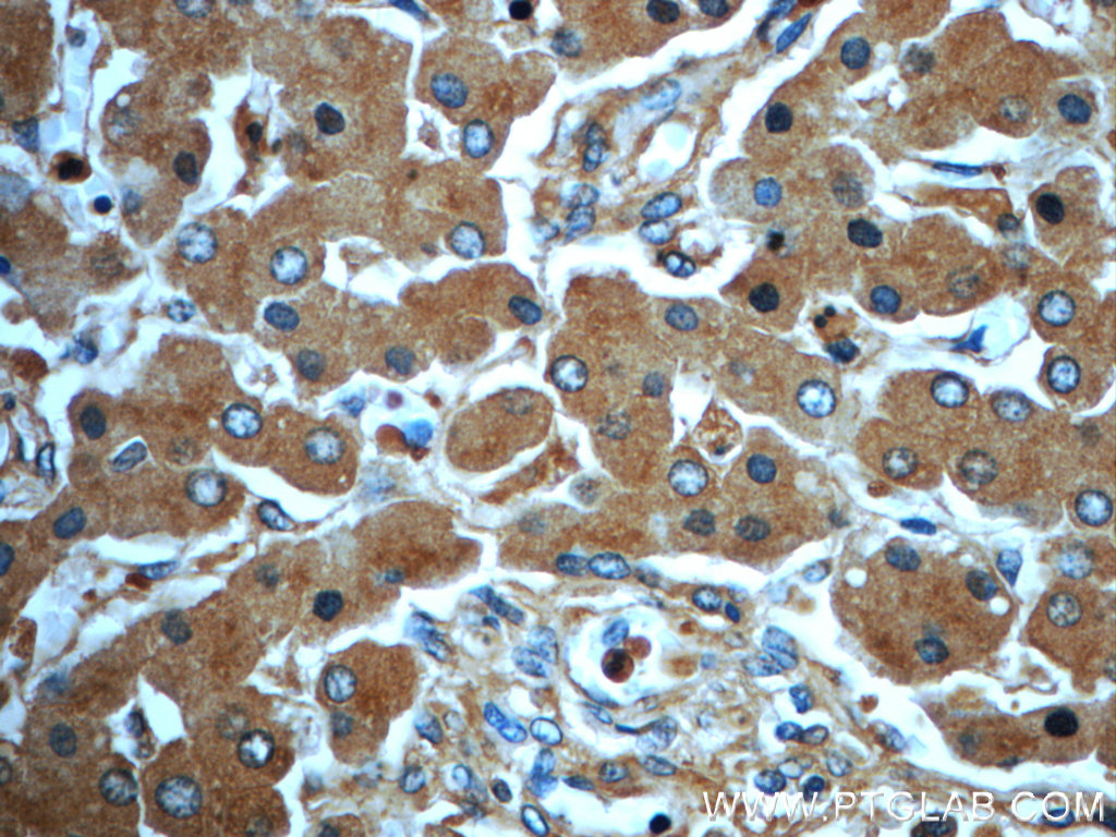 16439-1-AP;human liver tissue