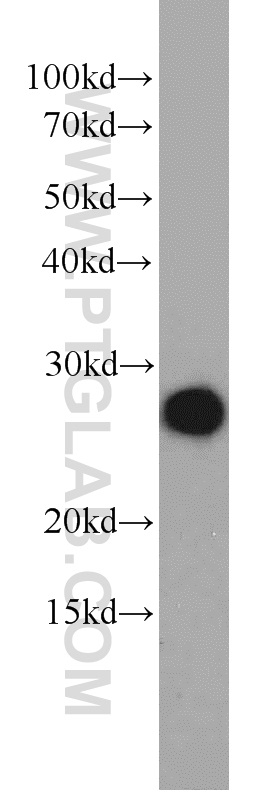 11199-1-AP;A549 cells