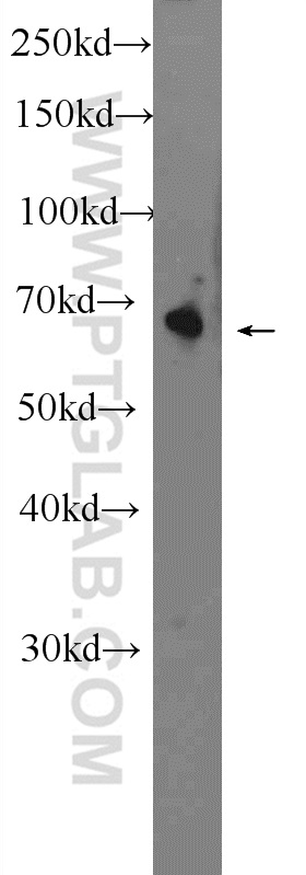 24456-1-AP;mouse heart tissue