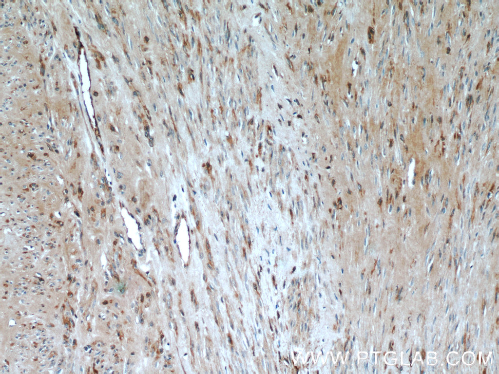 23045-1-AP;human hysteromyoma tissue