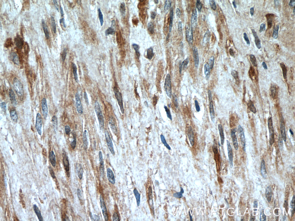 23045-1-AP;human hysteromyoma tissue