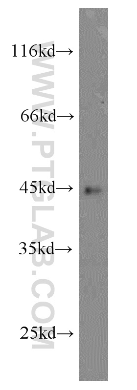 14443-1-AP;human spleen tissue