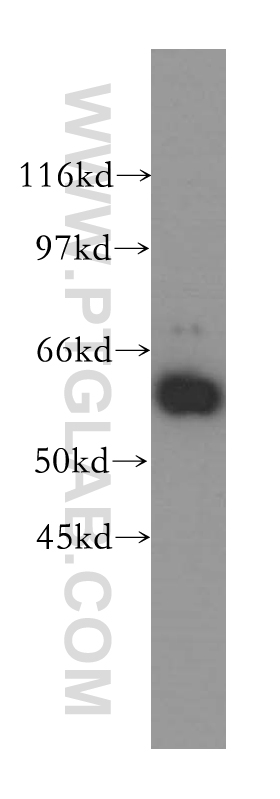 13759-1-AP;HeLa cells