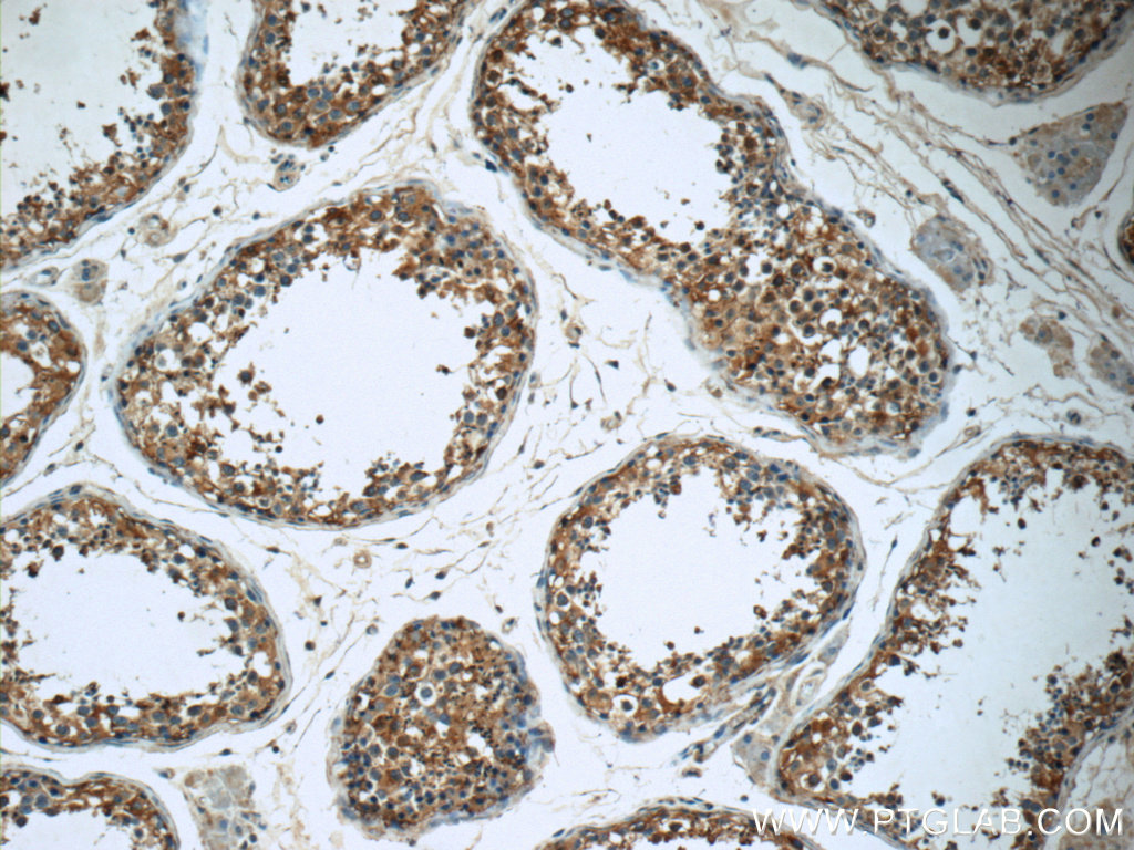 17650-1-AP;human testis tissue