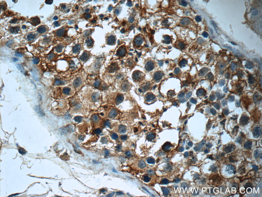 17650-1-AP;human testis tissue