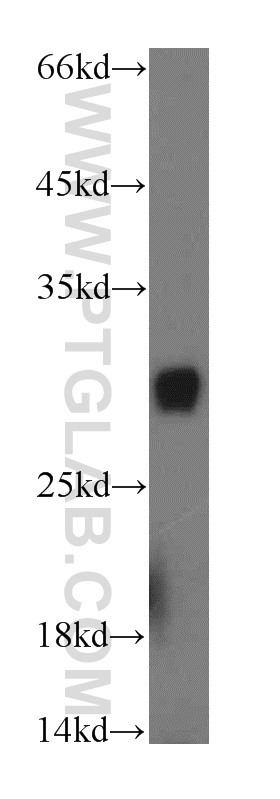 17650-1-AP;mouse brain tissue