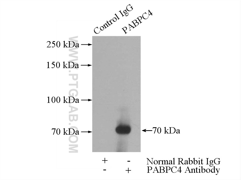 14960-1-AP;mouse heart tissue