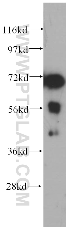 14960-1-AP;mouse heart tissue