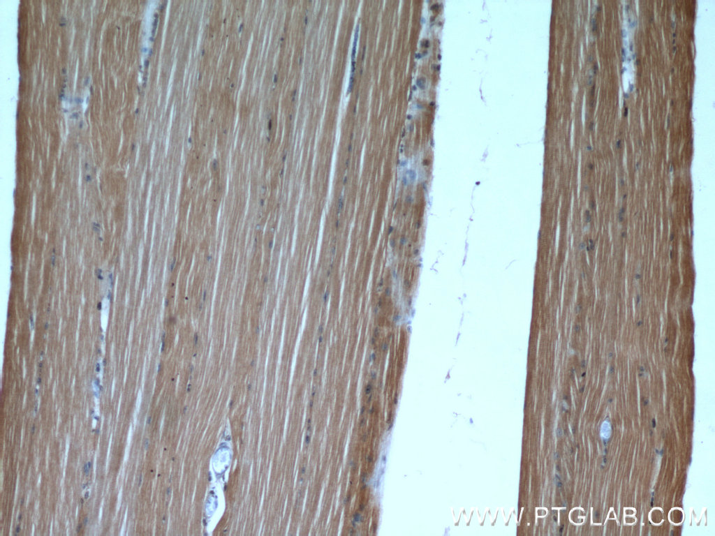 55310-1-AP;human skeletal muscle