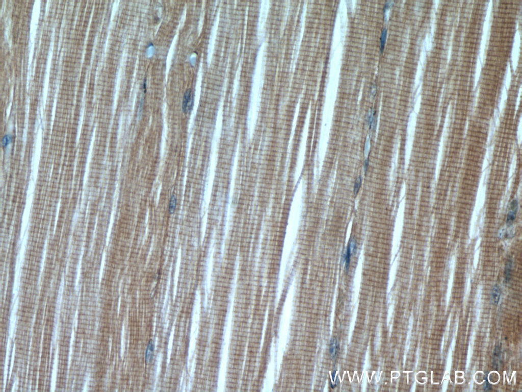 55310-1-AP;human skeletal muscle