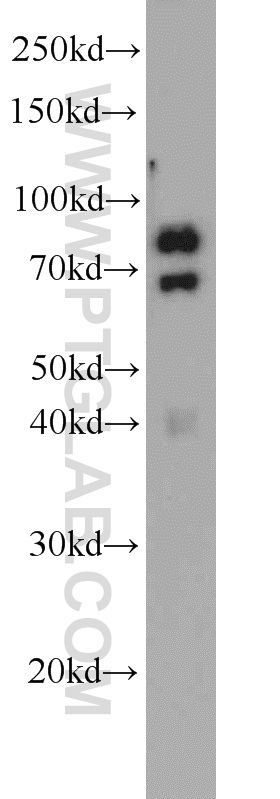 55310-1-AP;mouse skeletal muscle tissue