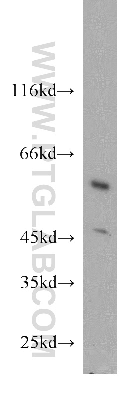 11001-1-AP;HeLa cells