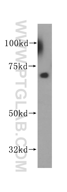 14708-1-AP;HepG2 cells