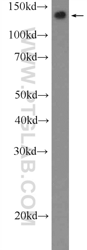 Parp10 Antibody 26072 1 Ap Proteintech 6274