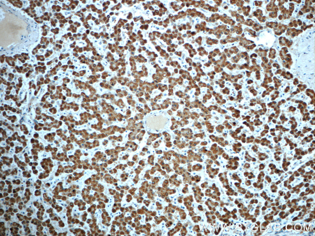 21988-1-AP;human liver