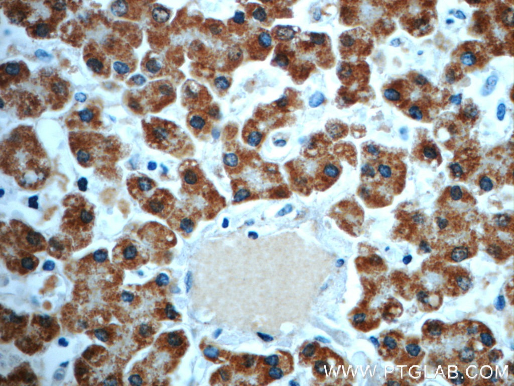 21988-1-AP;human liver