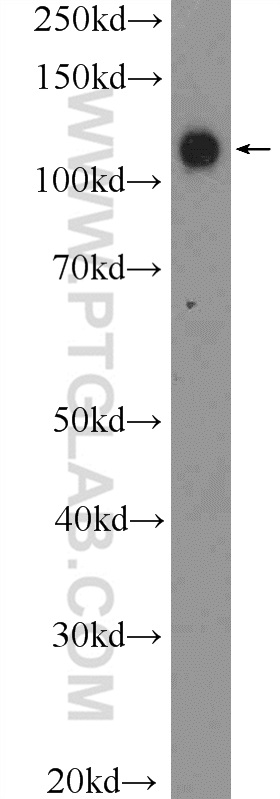 13645-1-AP;fetal human brain tissue