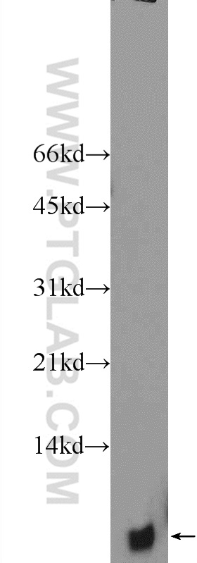 25933-1-AP;mouse brain tissue